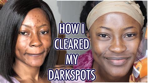 Why is my skin getting darker after using vitamin C serum?