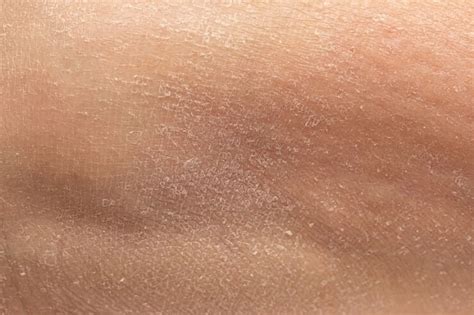 Why is my skin still dirty after showering?