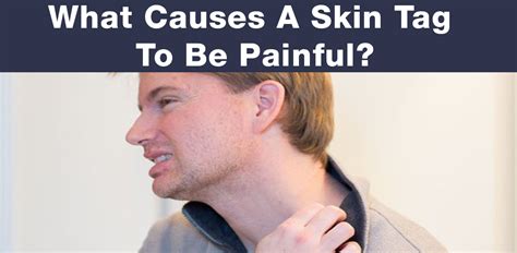 Why is my skin tag so painful?