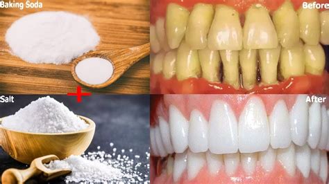 Why is salt good in toothpaste?
