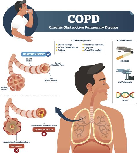 Why is there no high oxygen for COPD?