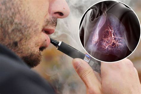 Why is vaping bad for lungs?
