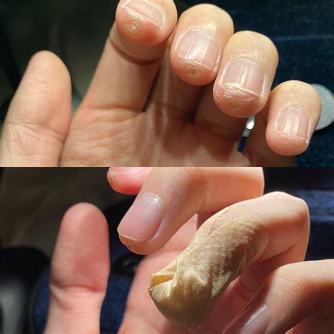 Why nails should not be cut?