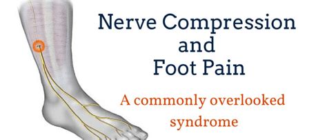 Why nerve pain in the feet?