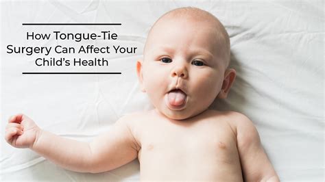 Why not to cut tongue-tie?