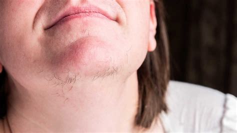 Why shouldn't you pluck your chin hair?