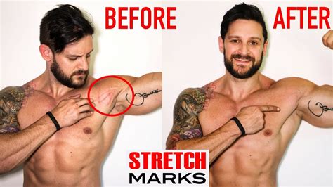 Why shouldn t you stretch?