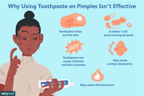 Why toothpaste is used for burns?