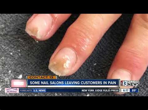Why was MMA banned nails?