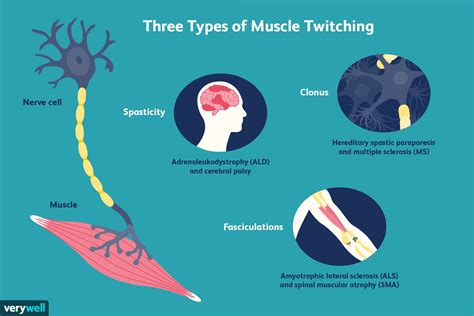 Why won't my muscles stop twitching?