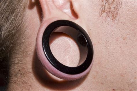 Why won't my stretched ears heal?