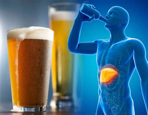 Will 6 beers a day cause liver damage?