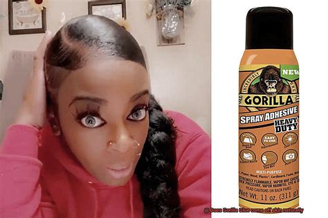 Will Gorilla Glue come off skin naturally?