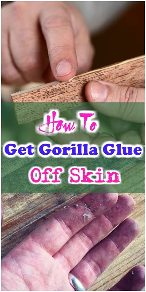 Will Gorilla Glue eventually come off skin?