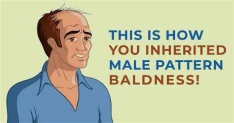 Will I bald if my father is?
