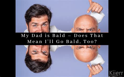 Will I go bald if my dad is?