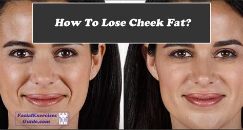 Will I lose cheek fat?