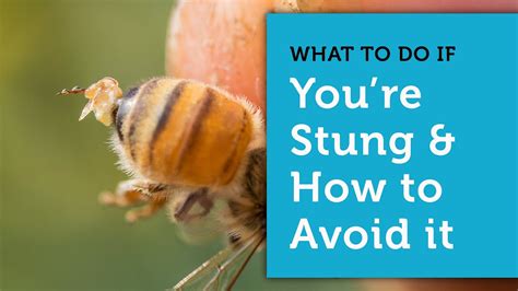 Will a bee sting you if you stay still?