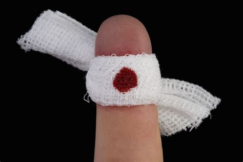 Will a cut finger stop bleeding?