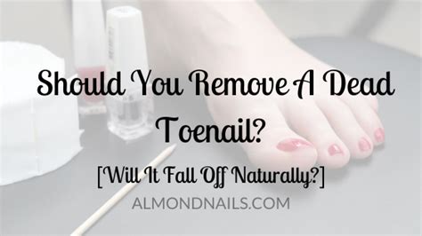 Will a dead toenail fall off naturally?