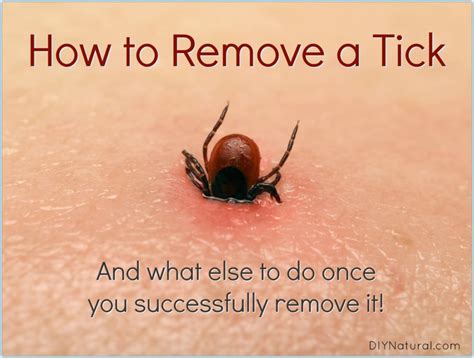 Will a tick head push itself out?
