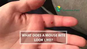 Will a wild mouse bite you?