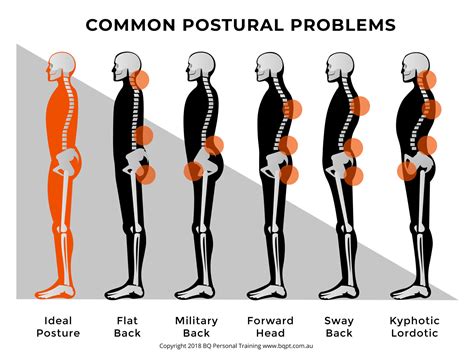 Will bad bed posture ruin your back?