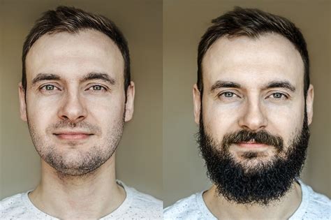 Will beard grow after 30?
