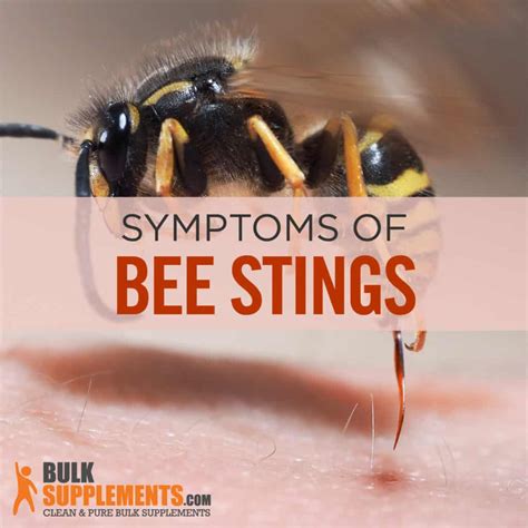 Will bees sting you if you walk past them?