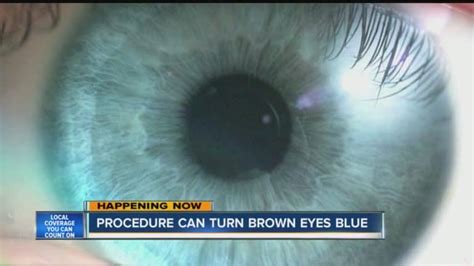 Will blue eyes disappear?
