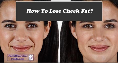 Will cheek fat go away?