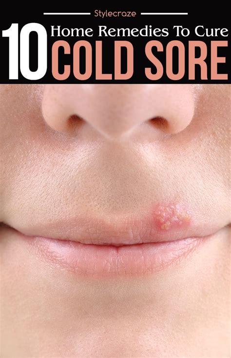Will cold sores ever be cured?