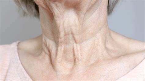 Will collagen help turkey neck?