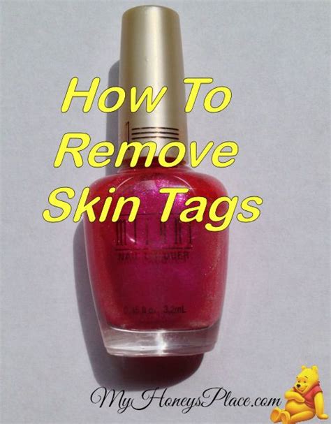 Will fingernail polish remove skin tags?