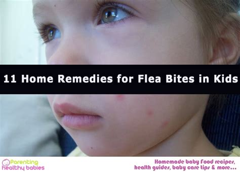 Will fleas bite your face?