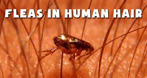 Will fleas live in human hair?