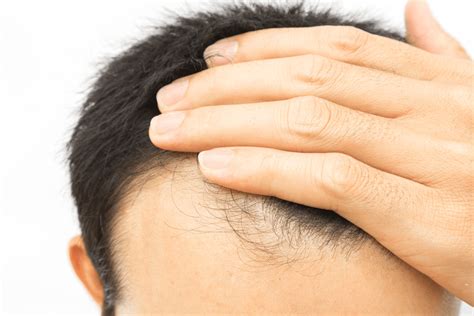 Will hair breakage grow back?