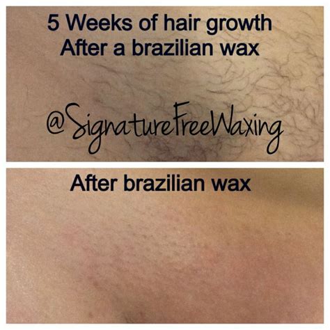 Will hair ever stop growing after waxing?