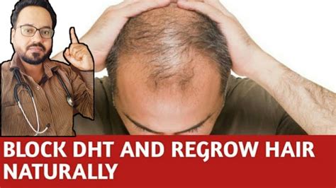 Will hair regrow if DHT is blocked?
