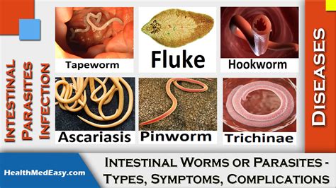 Will intestinal worms go away?