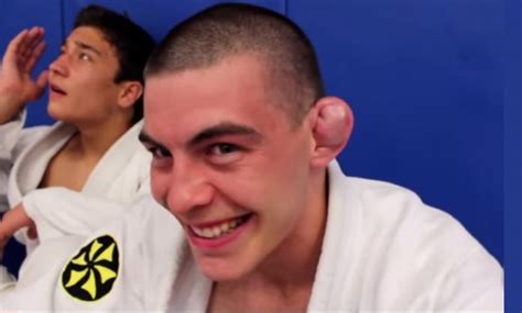 Will judo give you cauliflower ear?