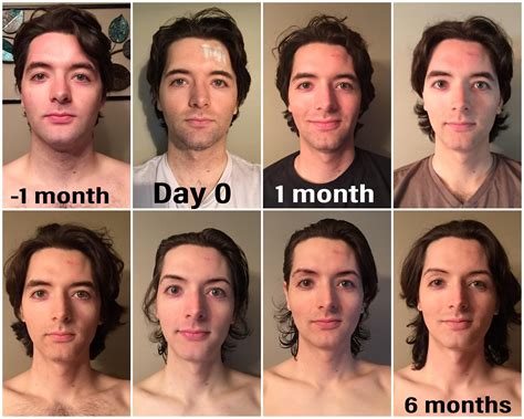 Will my face change after 17?