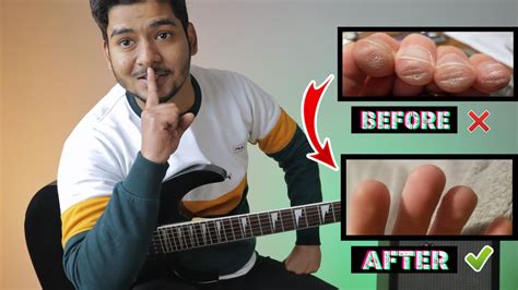 Will my fingers hurt less when playing guitar?