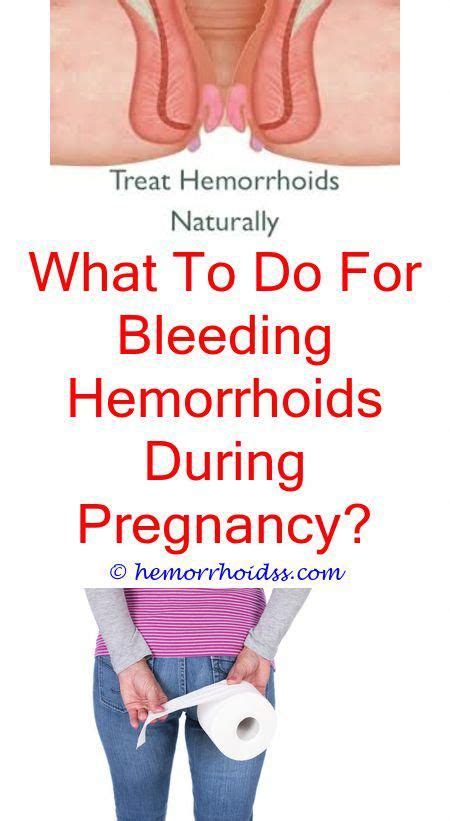 Will my hemorrhoid ever shrink?