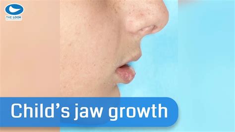 Will my jaw grow at 17?