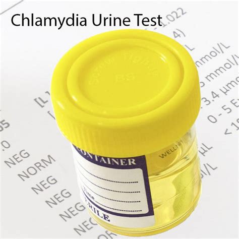 Will oral chlamydia show up in a urine test?