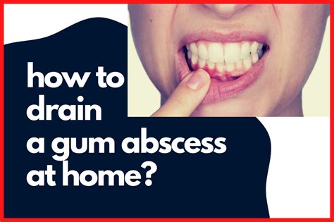 Will salt water drain a gum abscess?