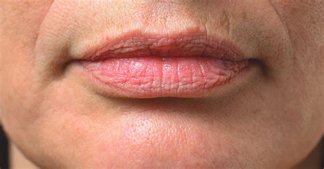 Will smokers lips go away?