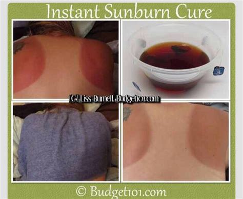 Will sunburn turn to tan?