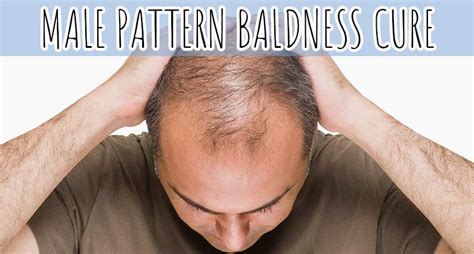 Will they ever find a cure for baldness?